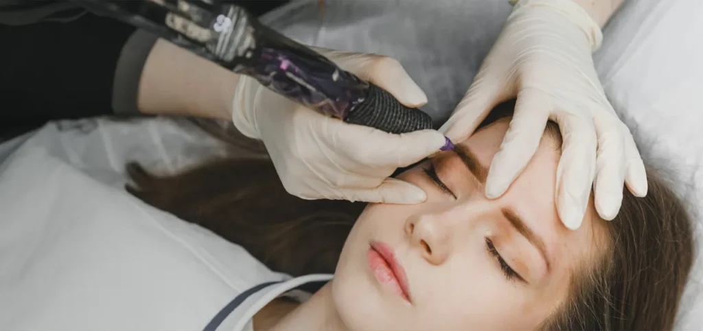 Custom SMP Treatments For Receding Hairlines And Patchy Thinning Areas