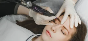 Custom SMP Treatments For Receding Hairlines And Patchy Thinning Areas