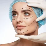 Discussing The Key Steps Used in Facial Feminization Surgery